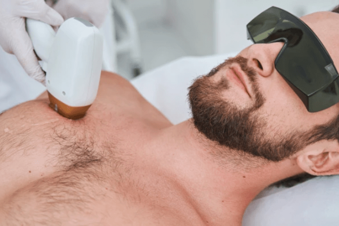 laser hair removal toronto