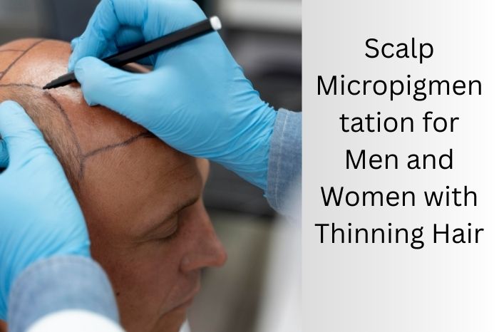 scalp micropigmentation