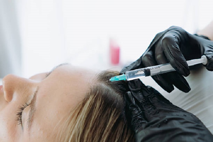 Exosomes Therapy for Hair Loss in Riyadh