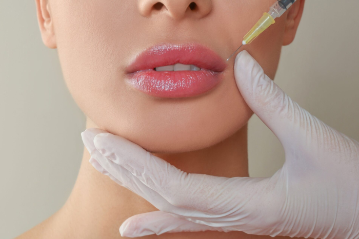 lip injections