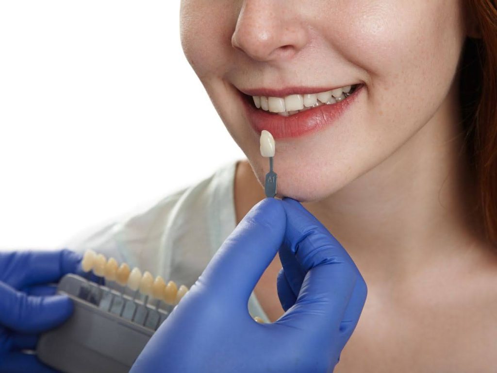 smiles dental implants