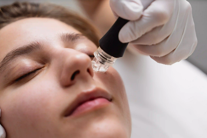 Potenza skin treatment