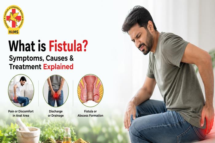 What is Fistula?