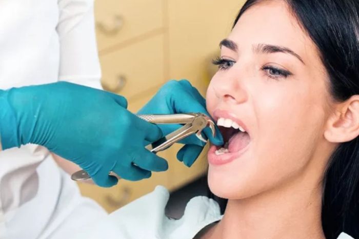 Recovery Tips After Wisdom Teeth Extractions