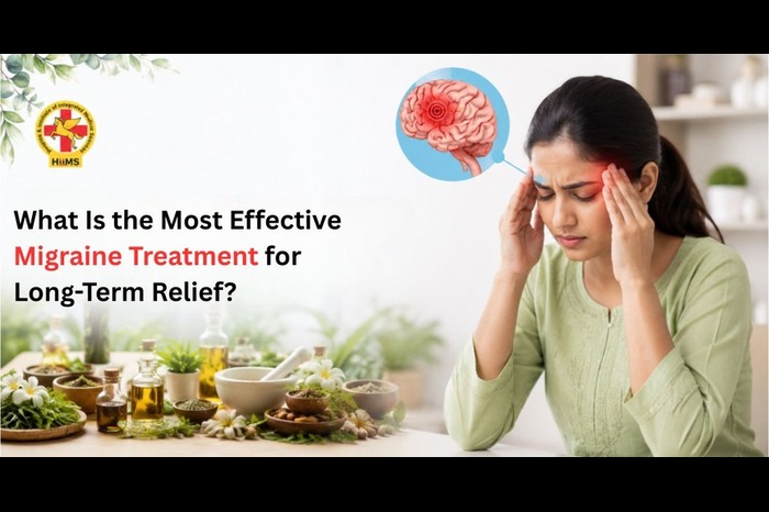 Migraine Treatment