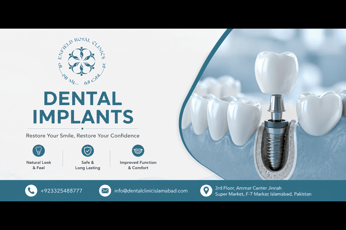 Best Dental Implants in Islamabad