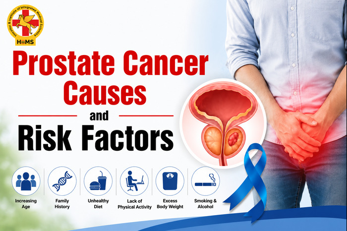 Prostate Cancer Causes