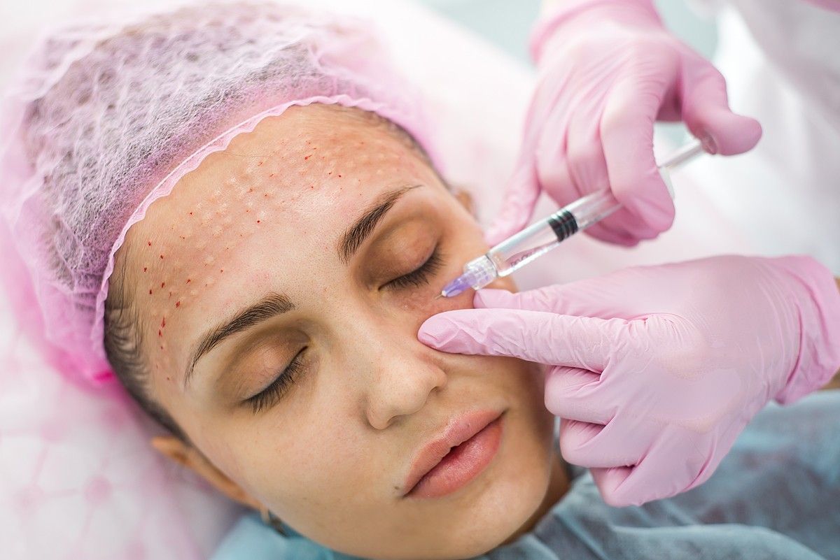 mesotherapy in islamabad