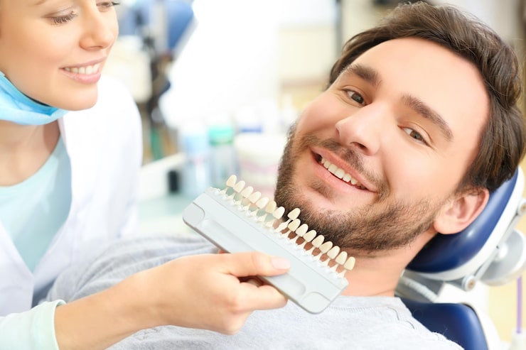 Teeth Veneers