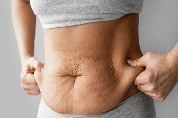 Tummy Tuck Surgery in Islamabad