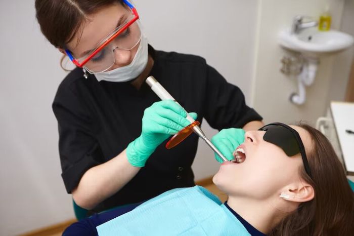 dental implants